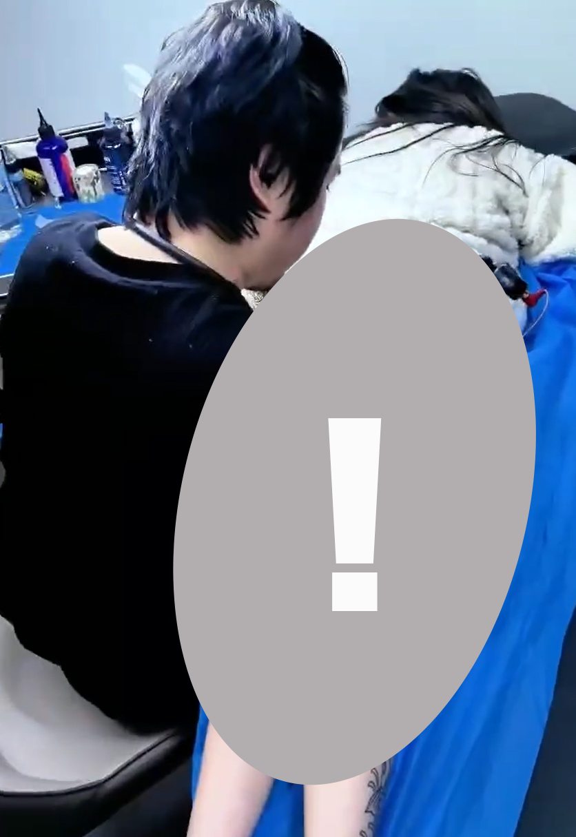 May be an image of acupuncture